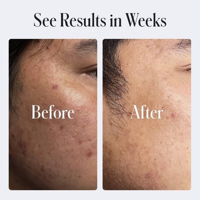 Imagen de producto 5