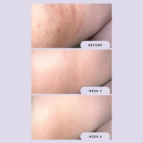 Imagen de producto 5