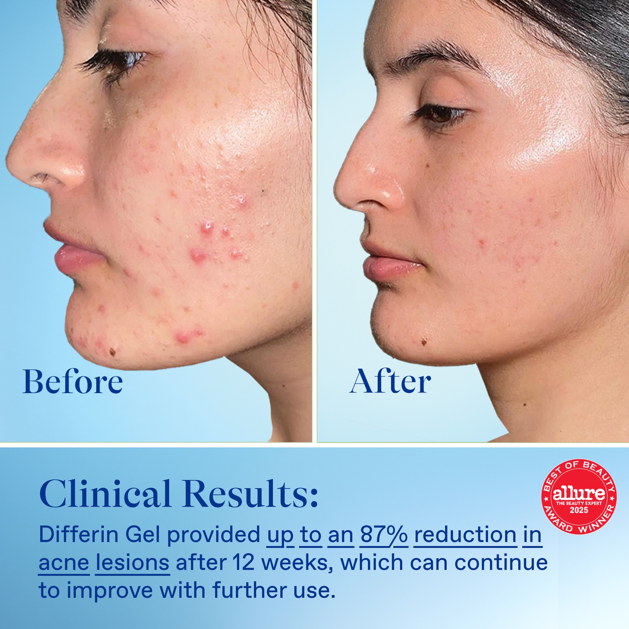 Immagine del prodotto 4